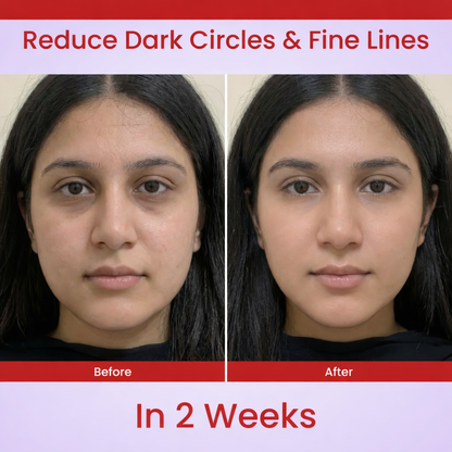 DawnShoppers™ Skincare Wand with Red Light Therapy